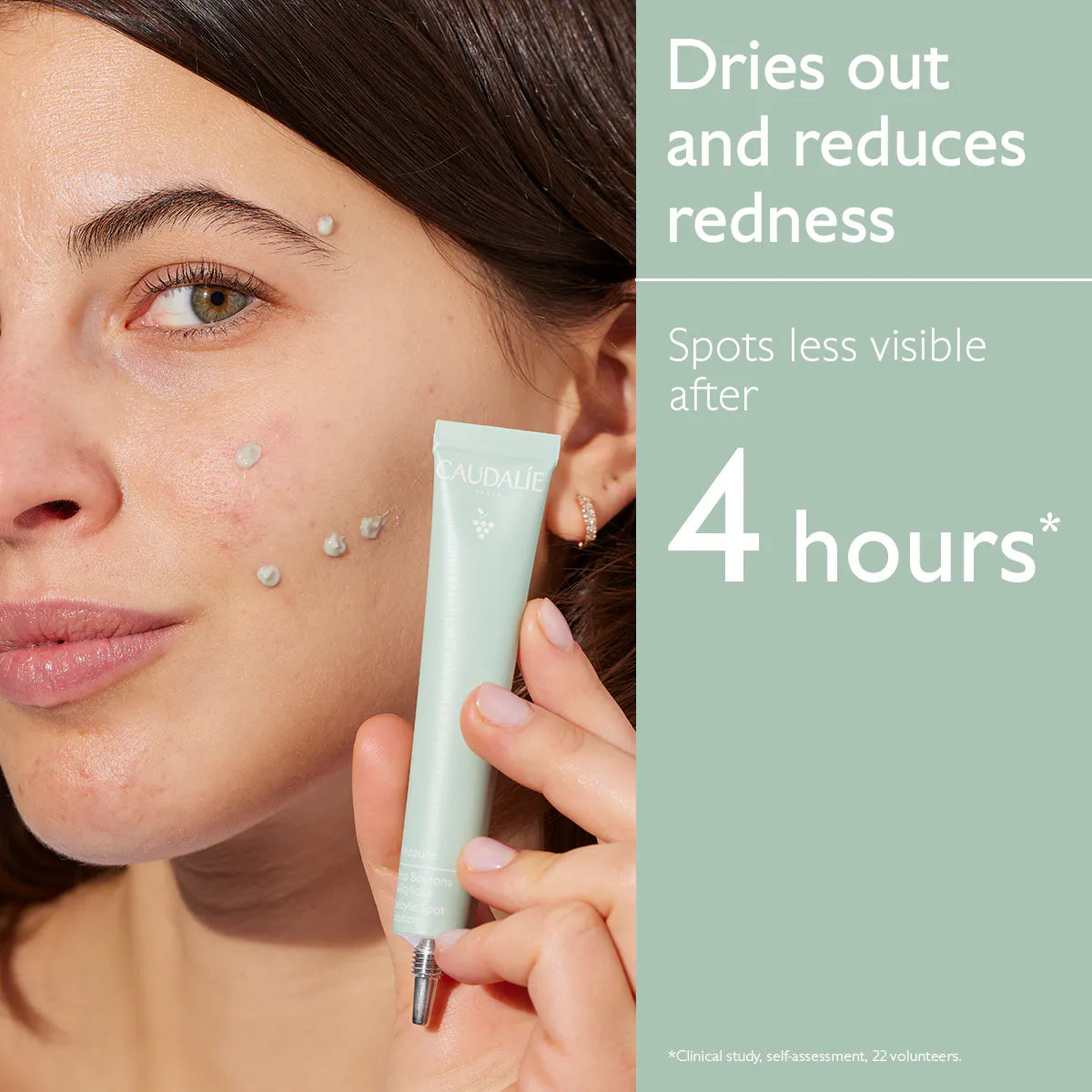 Vinopure
Salicylic Spot Solution