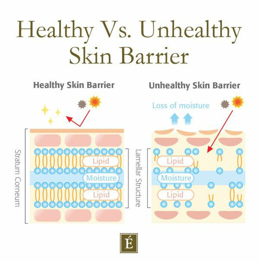 What Is Your Skin Barrier & How To Protect It