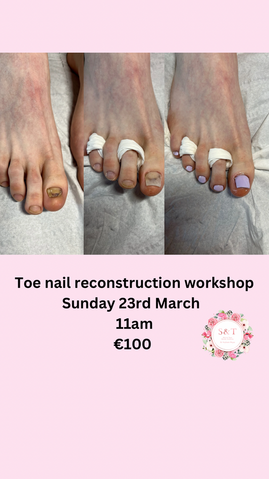 Toe nail reconstruction workshop