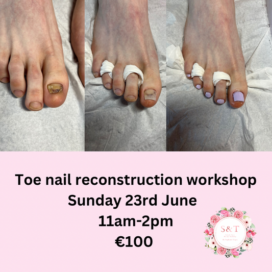 Toe nail reconstruction workshop